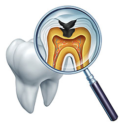The image shows a magnified view of a human tooth with its internal structure visible through a transparent surface, and a dental magnifying glass with an X-ray film inserted into it, revealing a detailed image of the tooth s roots and surrounding tissues.