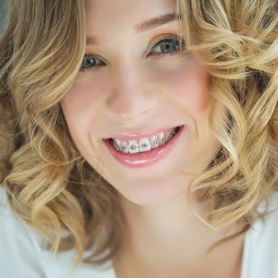 A smiling woman with straight teeth, wearing a white top, against a neutral background.
