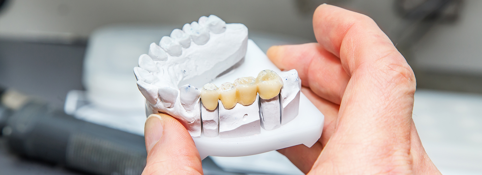 An individual is holding a model of a human mouth with visible teeth and gums, likely for educational or demonstration purposes.