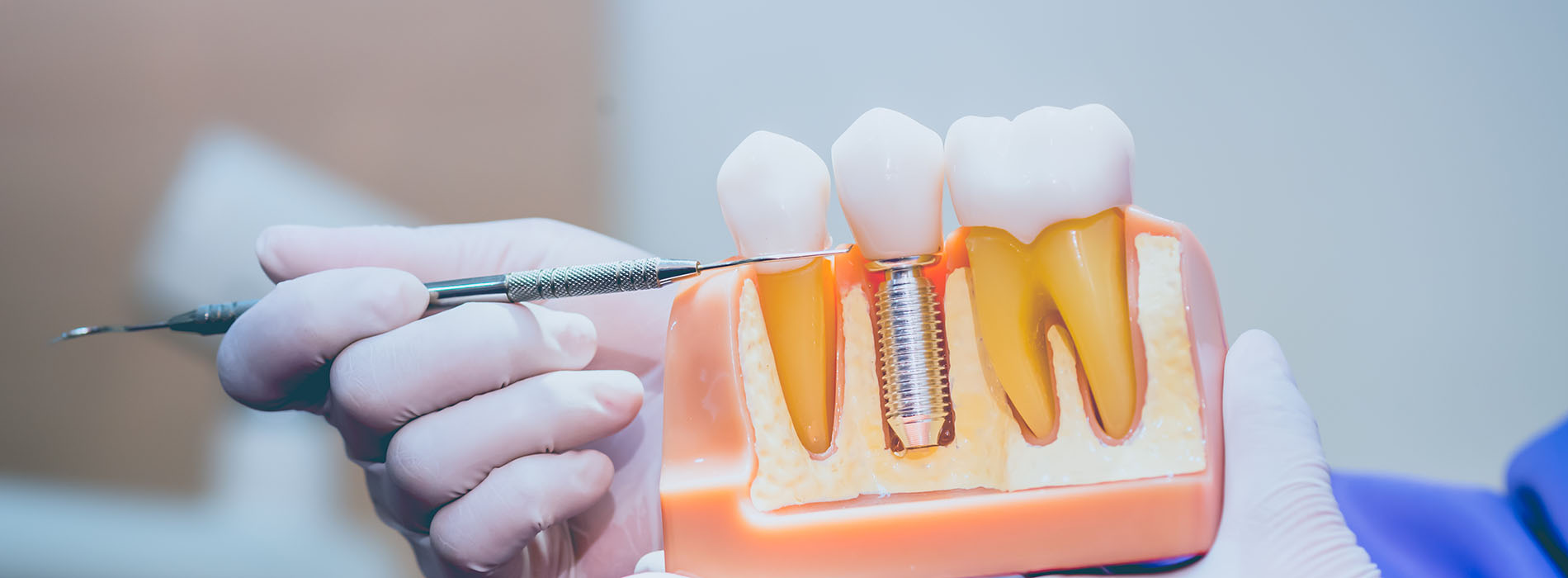 The image shows a person using dental tools on a model set of teeth with fake gums, likely for educational purposes.