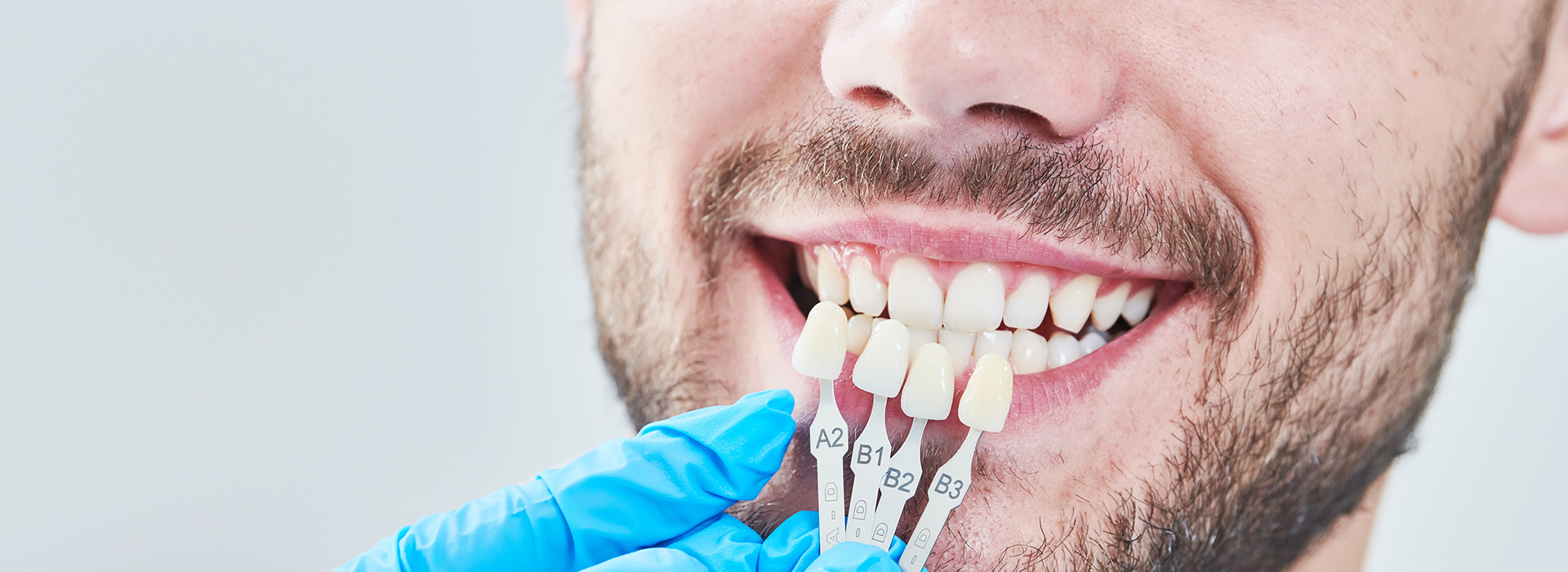 The image shows a person with a smile, wearing dental braces, being photographed from a close-up angle with a focus on their teeth and mouth area.