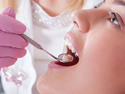 A dental hygienist using a power tool to clean a patient s teeth.